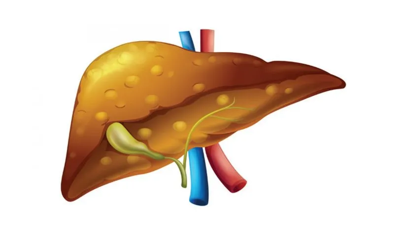 Rising liver ailments a concern; diet key to health and overall wellness: Experts